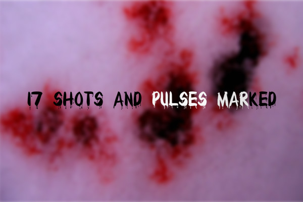 Fanfic / Fanfiction 17 shots and pulses marked