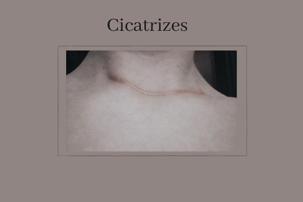 Fanfic / Fanfiction Cicatrizes - Solangelo