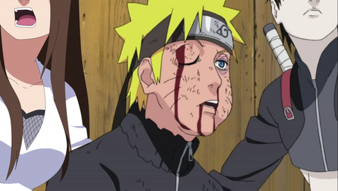 Em Naruto, por que Samui é branco quando todos os outros da vila
