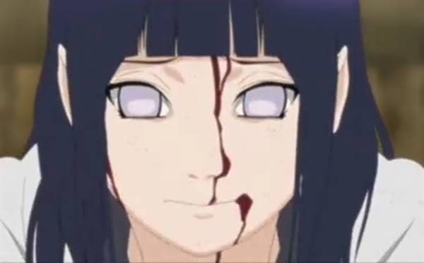 Fanfic / Fanfiction Naruto e Hinata: E o depois? - Situação Inesperada