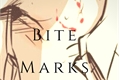 História: Bite Marks