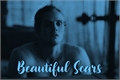 História: Beautiful Scars