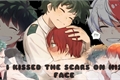 História: I kissed the scars on his face... | TODODEKU