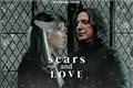 História: Scars and love